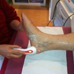 Behandlung Fersensporn